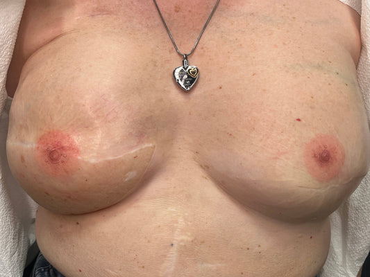 Areola Tattoo